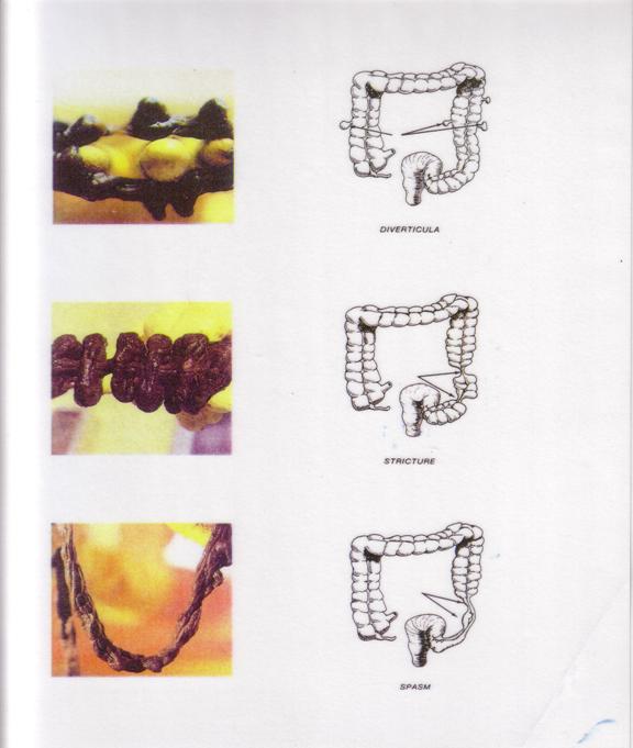So Easy Slim Care Nutri - Scheme